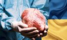 На Украине раскрыли «чёрных трансплантологов» — боевиков ВСУ лишают органов